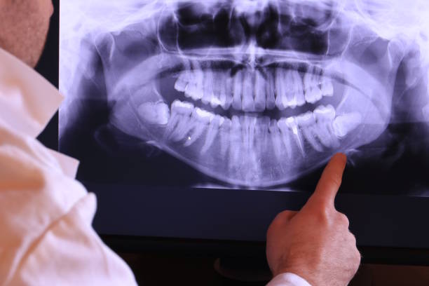 Best Emergency Dental Surgery in Waterflow, NM